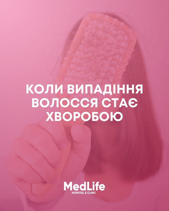 Коли випадіння волосся стає хворобою